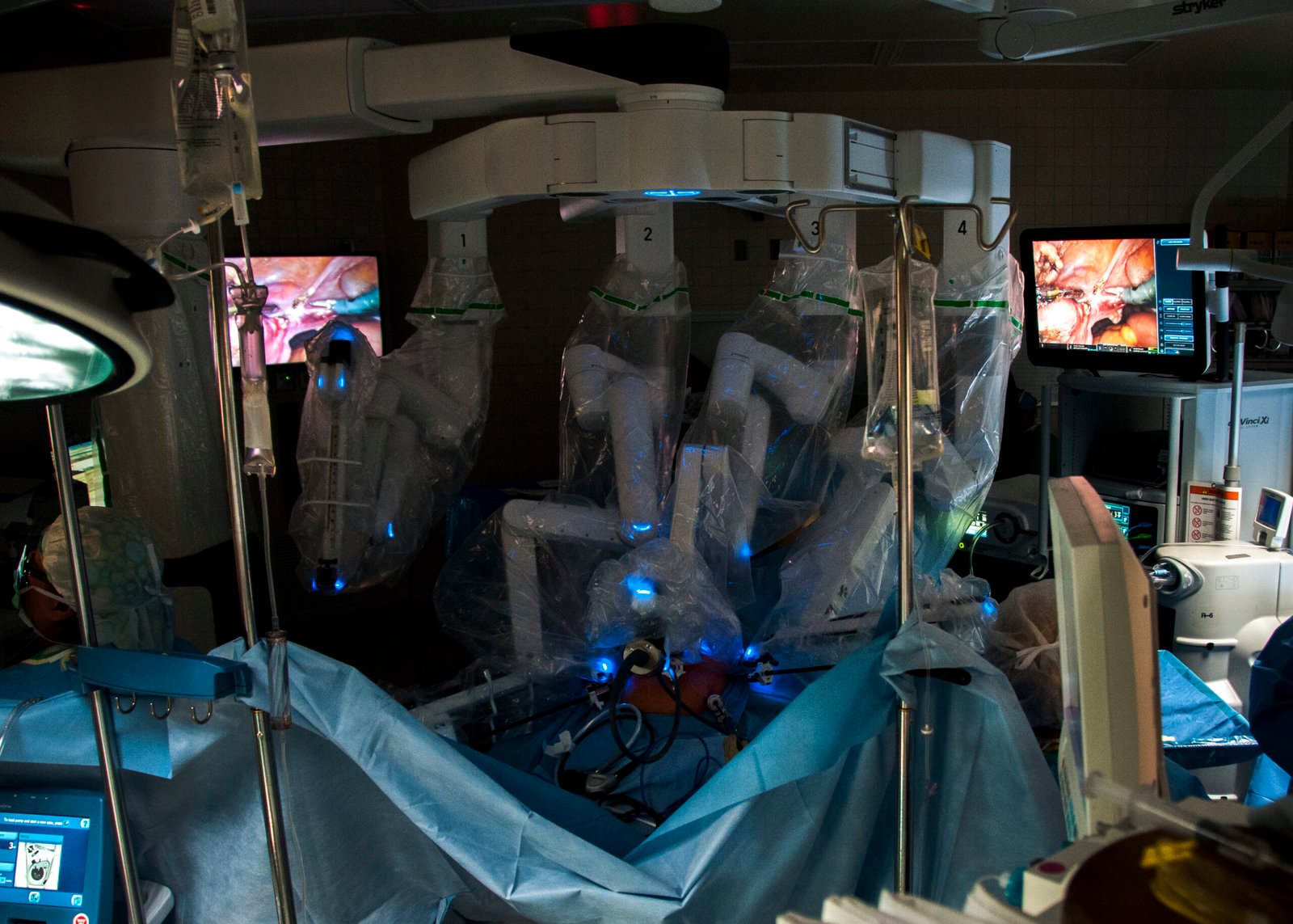 A robotic-assisted surgery system in an operating room, representative of the growing adoption of robotic surgical platforms in the U.S.