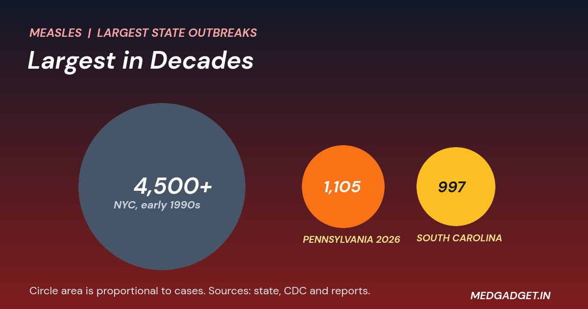 largest measles outbreak in decades: circles sized by cases for New York City in the early 1990s, Pennsylvania in 2026 and South Carolina
